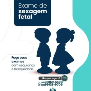 Exame de Sexagem Fetal